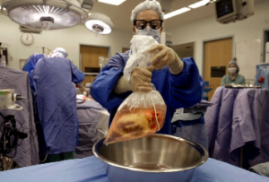 PA OPOs respond to PennLive's article series on organ donation.