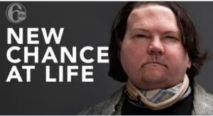 Philly program helps make face, double hand transplant reality.